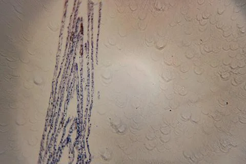 A stained microscope image showing filamentous fungal. Stock Photos