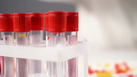 Stand with blood sample test tubes in research medical laboratory. Test tube Stock Footage 132369201