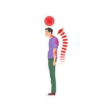 Standing man with incorrect spine posture 스톡 일러스트