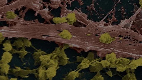 Staphylococcus aureus Bacteria, SEM Stock-Footage 113239729
