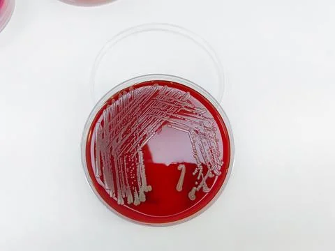Staphylococcus aureus: Gram-positive, to Gram-variable,beta haemolysis Fotos de archivo