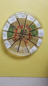 Staphylococcus aureus oxacillin agar third check plate Foto stock