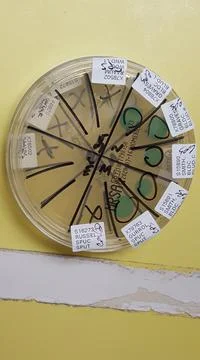 Staphylococcus aureus oxacillin agar third check plate Stock Photos