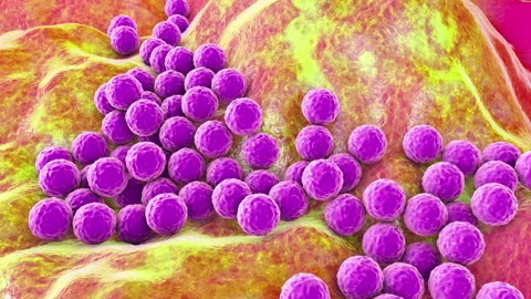 Staphylococcus Skin Stock Footage ~ Royalty Free Stock Videos | Pond5