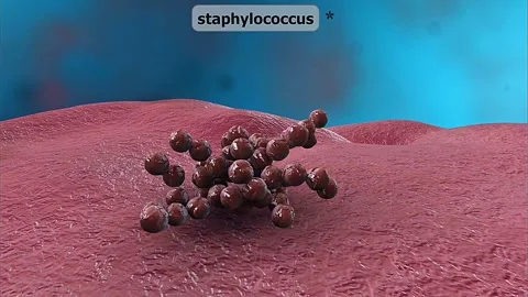 Staphylococcus Bacteria Stock Footage 305167354