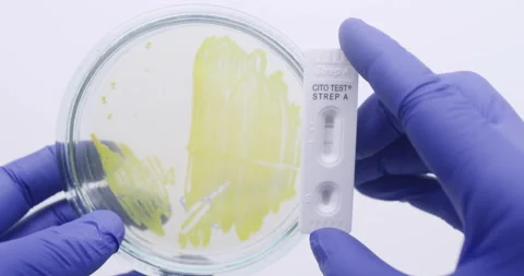 Staphylococcus bacteria in a petri dish. Stock Footage 310517402