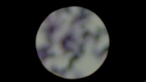 Staphylococcus bacteria under the microscope. Laboratory research concept. Focus Stock Footage 108545268
