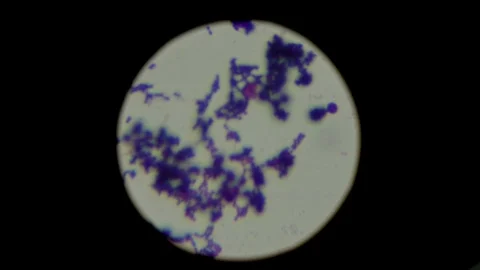 Staphylococcus bacteria under the microscope. Sample of anaerobic organism. Stock-Footage 108545173