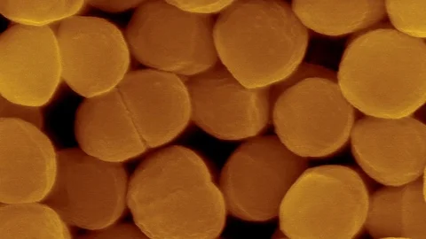 Staphylococcus warneri, coccoid prokaryote, SEM Stock-Footage 79704871