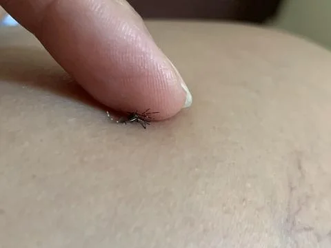 Static Close Up Macro of Crushed Dead Mosquito Stain on Human Finger Stock Photos