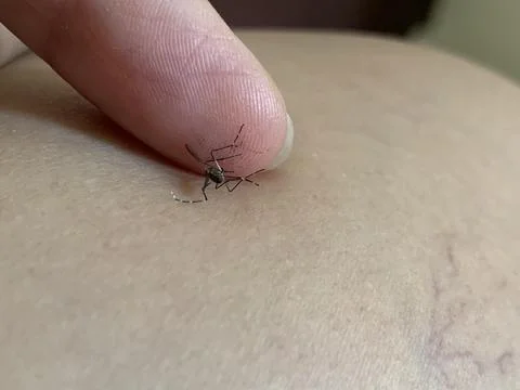 Static Close Up Macro of Crushed Dead Mosquito Stain on Human Finger Stock Photos
