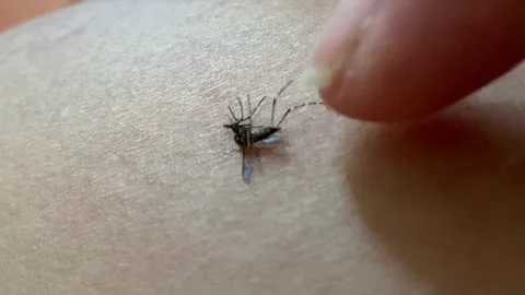 Static Closeup Macro Index Finger Checking Swatted Mosquito on The Skin 4K 스톡 동영상 343067555