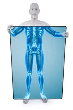Statue xray Stock-Illustration