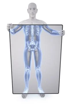 Statue xray Stock-Illustration