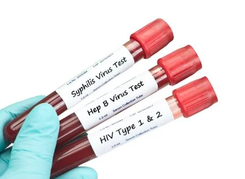 STD Blood Tests Stock Photos