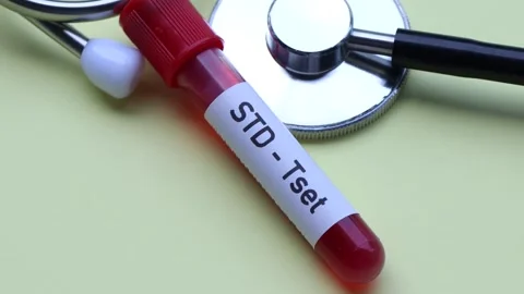 STD test to look for abnormalities from blood Stock Footage 237905362