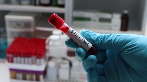 STD test to look for abnormalities from blood Stock Footage 237905394