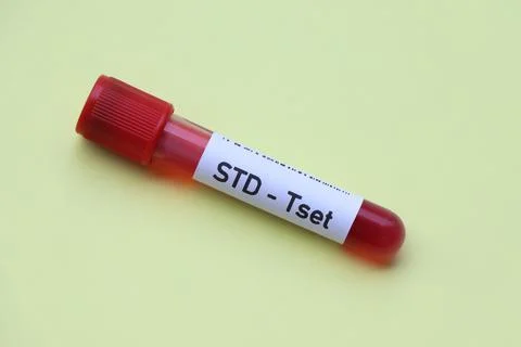 STD test to look for abnormalities from blood Stock-Fotos