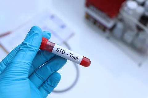 STD test to look for abnormalities from blood Stockfoto's