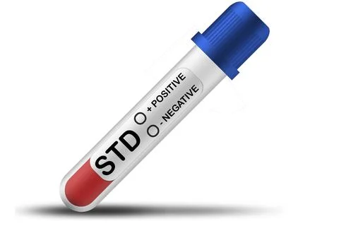 STD test tube isolated with white background Stock Illustration