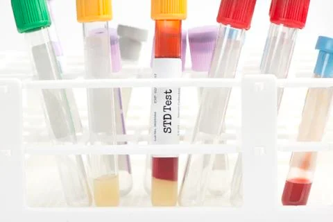 STD Testing Stock Photos
