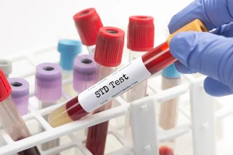 STD Testing Stock Photos