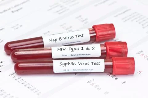 STD Tests Stock Photos