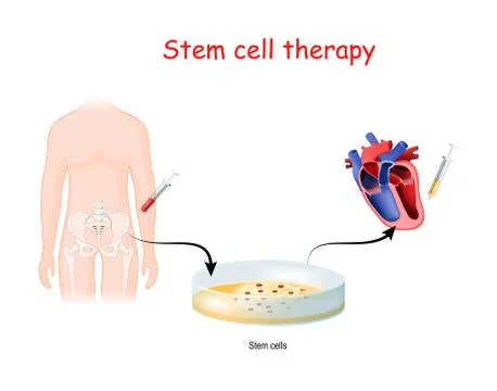 Stem cell therapy Stock Illustration