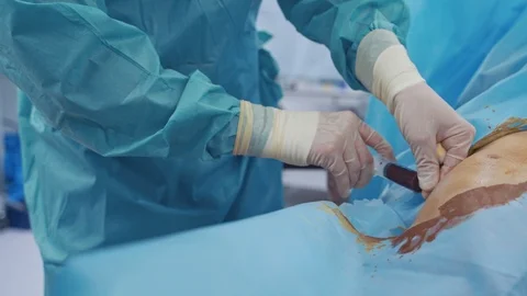 Stem cells injection. Doctor makes blood injection into the patient's body. Stock Footage 119963323