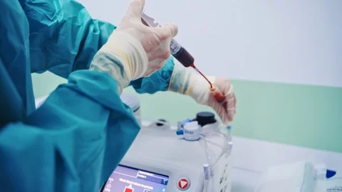 Stem cells injection procedure. Female worker pours blood from syringe Video stock 119962938
