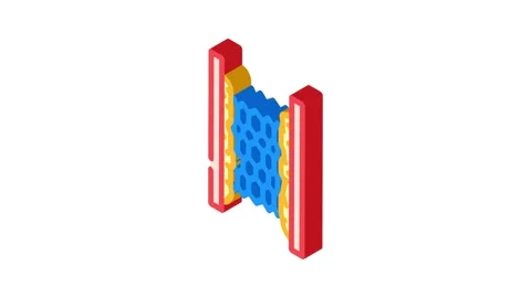 Stent placement surgery isometric icon animation Stock Footage 327283090