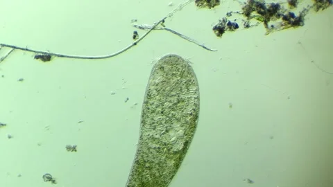 A stentor under the optical microscope 100x magnification Stock Footage 314638056