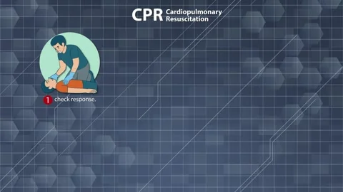 Step-by-Step Cardiopulmonary Resuscitation (CPR) Instructional Animation Stock Footage 320092005