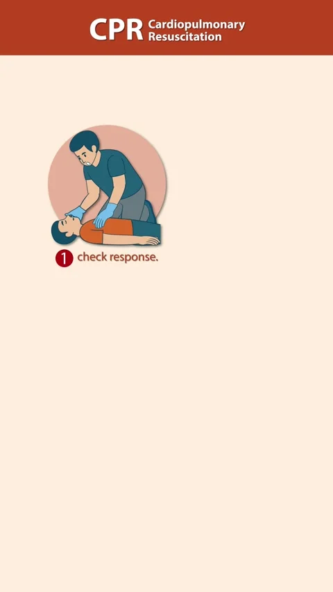 Step-by-Step CPR Instructions for Cardiopulmonary Resuscitation Animation Stock Footage 318939427
