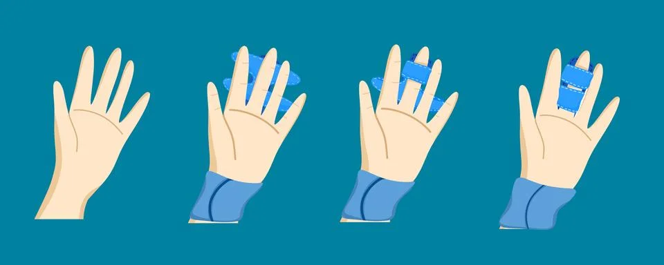 Step-by-Step Finger Bandage Tutorial for Hand Injury Care Stock Illustration