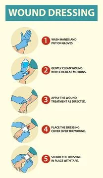 Step-by-Step Guide to Effective Wound Dressing Stock Illustration