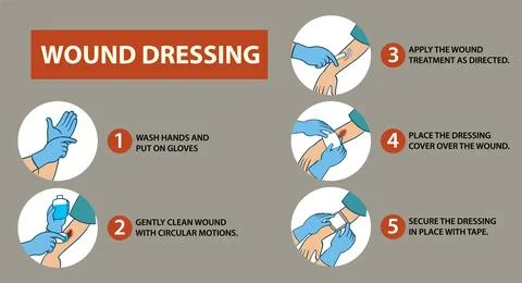 Step-by-Step Guide to Wound Dressing 스톡 일러스트