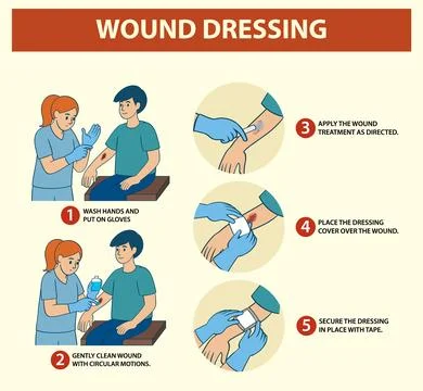 Step-by-Step Guide to Wound Dressing Stock Illustration