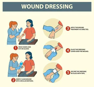Step-by-Step Guide to Wound Dressing Stock Illustration
