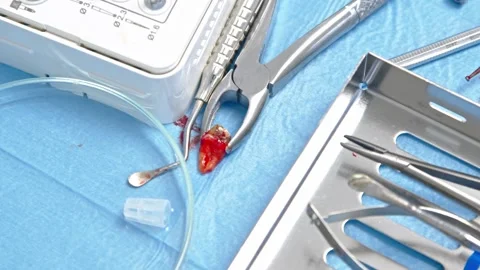 Sterile prepared dental extraction tools. Stainless steel tools for surgery Stock-Footage 300578044