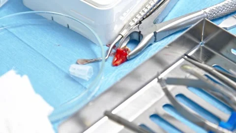 Sterile prepared dental extraction tools. Stainless steel tools for surgery Stock-Footage 300578045