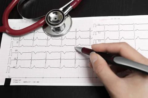 Stethoscope and cardiogram Stock Photos