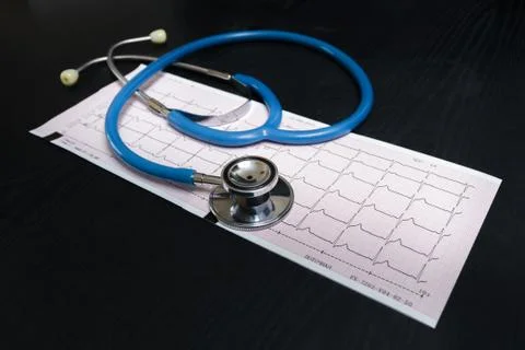 Stethoscope and cardiogram Stock Photos