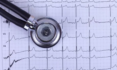 Stethoscope and ecg Stock Photos