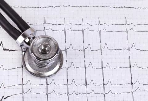 Stethoscope and ecg Stock Photos