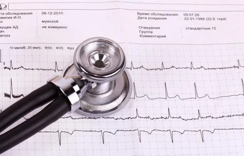 Stethoscope and ecg Stock Photos