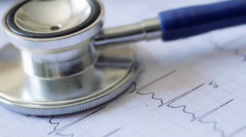 Stethoscope and EKG chart 스톡 동영상 28702228