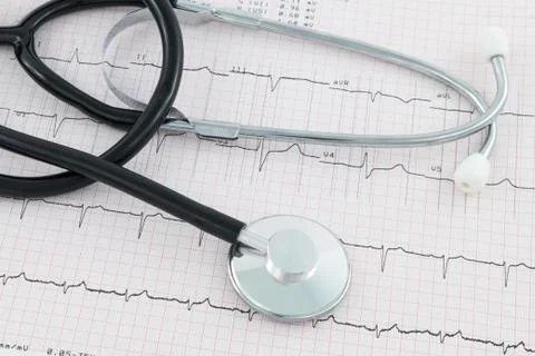 Stethoscope on cardiogram 스톡 사진