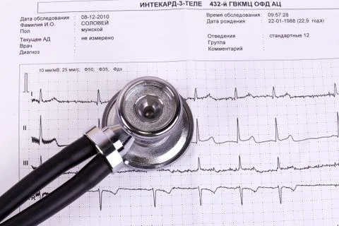 Stethoscope on ECG Stock Photos