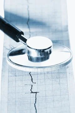 Stethoscope on ecg Stock Photos